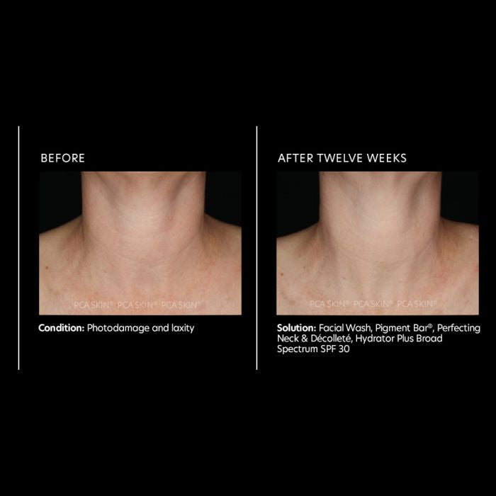 Perfecting Neck and Décolleté